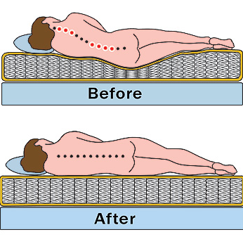 sagging bed back pain